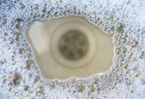 Clogged kitchen sink